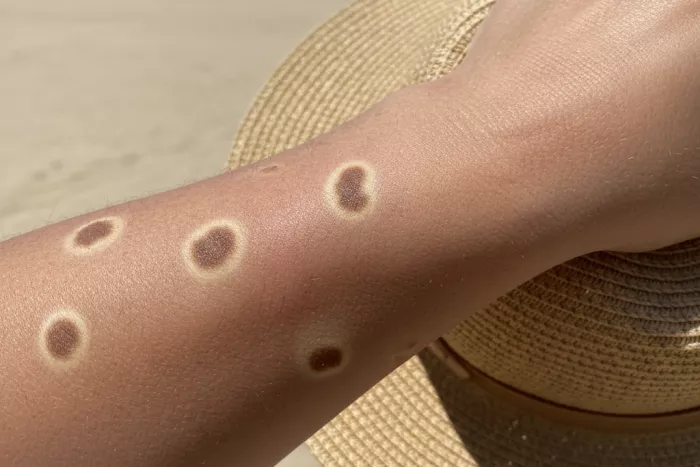Brown leaf spots with yellow halos causes
